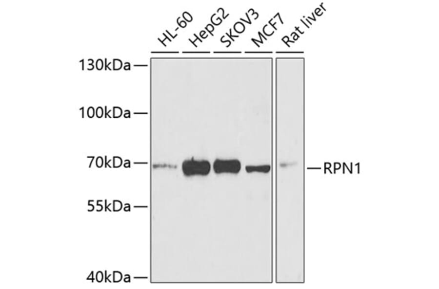 Western Blot - Anti-Ribophorin I Antibody (A15350) - Antibodies.com