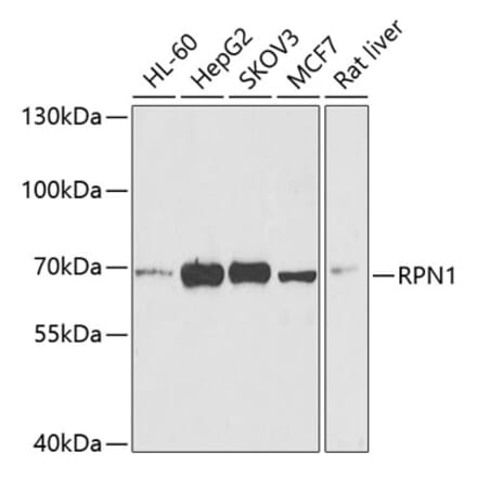 Western Blot - Anti-Ribophorin I Antibody (A15350) - Antibodies.com