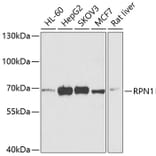 Western Blot - Anti-Ribophorin I Antibody (A15350) - Antibodies.com