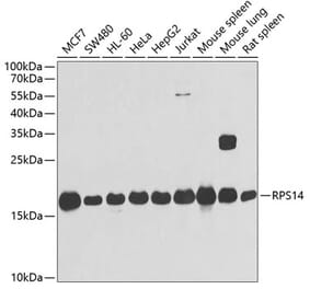 Western Blot - Anti-RPS14 Antibody (A15351) - Antibodies.com