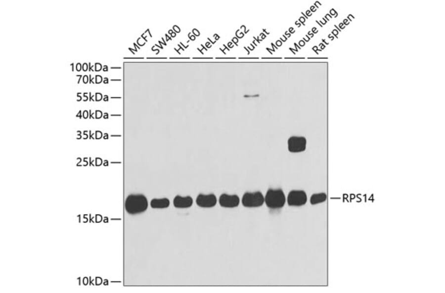 Western Blot - Anti-RPS14 Antibody (A15351) - Antibodies.com