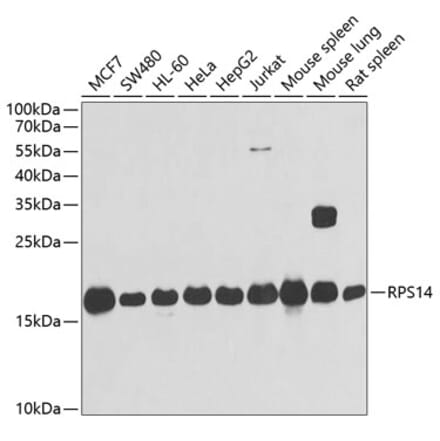 Western Blot - Anti-RPS14 Antibody (A15351) - Antibodies.com