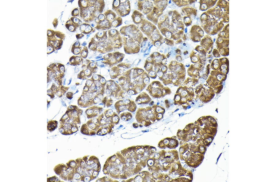 Immunohistochemistry - Anti-RPS14 Antibody (A15351) - Antibodies.com