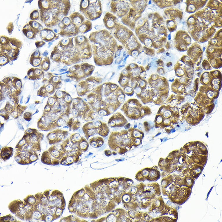 Immunohistochemistry - Anti-RPS14 Antibody (A15351) - Antibodies.com