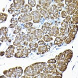 Immunohistochemistry - Anti-RPS14 Antibody (A15351) - Antibodies.com