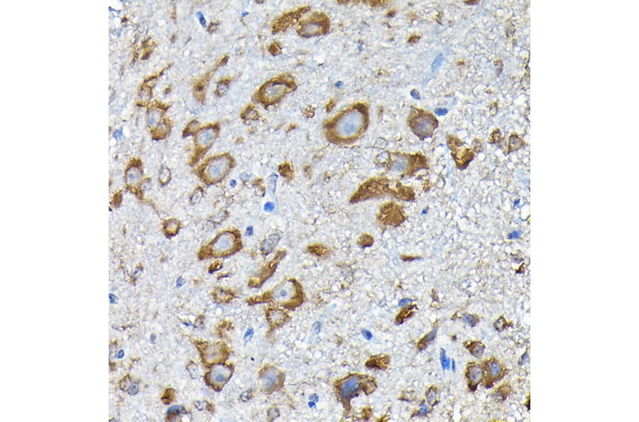 Immunohistochemistry - Anti-RPS14 Antibody (A15351) - Antibodies.com