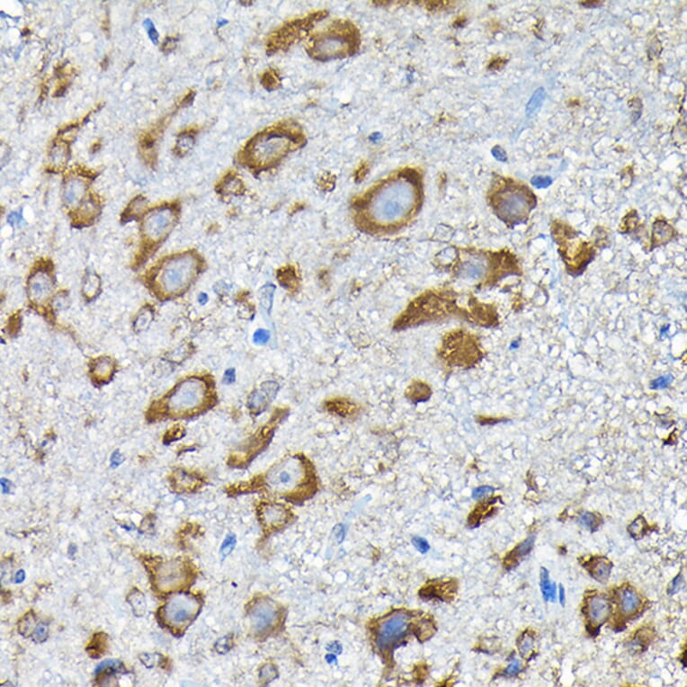 Immunohistochemistry - Anti-RPS14 Antibody (A15351) - Antibodies.com