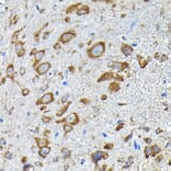 Immunohistochemistry - Anti-RPS14 Antibody (A15351) - Antibodies.com