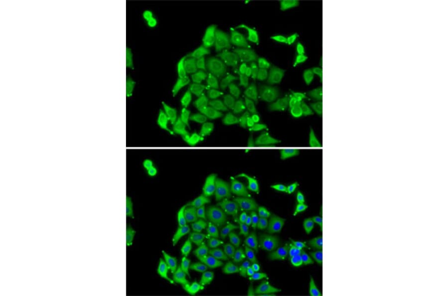Immunofluorescence - Anti-RPS14 Antibody (A15351) - Antibodies.com