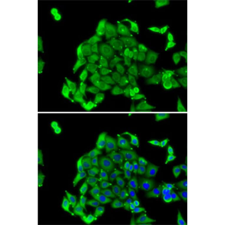 Immunofluorescence - Anti-RPS14 Antibody (A15351) - Antibodies.com