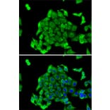 Immunofluorescence - Anti-RPS14 Antibody (A15351) - Antibodies.com