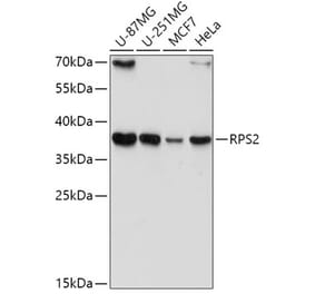 Western Blot - Anti-RPS2 Antibody (A15352) - Antibodies.com