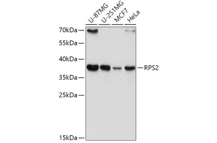 Western Blot - Anti-RPS2 Antibody (A15352) - Antibodies.com