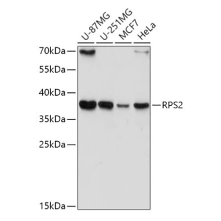 Western Blot - Anti-RPS2 Antibody (A15352) - Antibodies.com