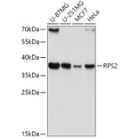 Western Blot - Anti-RPS2 Antibody (A15352) - Antibodies.com