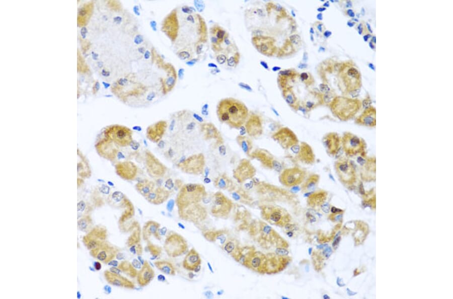 Immunohistochemistry - Anti-RPS2 Antibody (A15352) - Antibodies.com