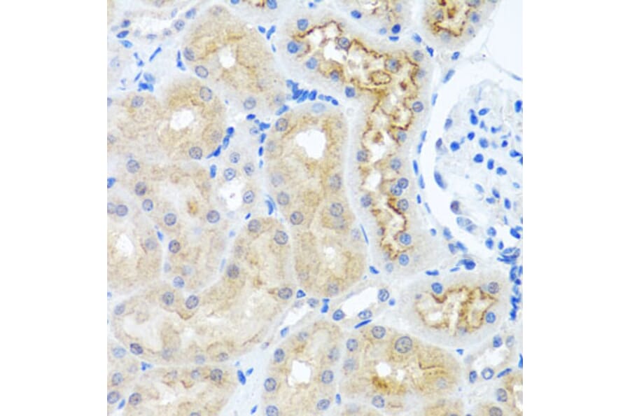 Immunohistochemistry - Anti-RPS2 Antibody (A15352) - Antibodies.com