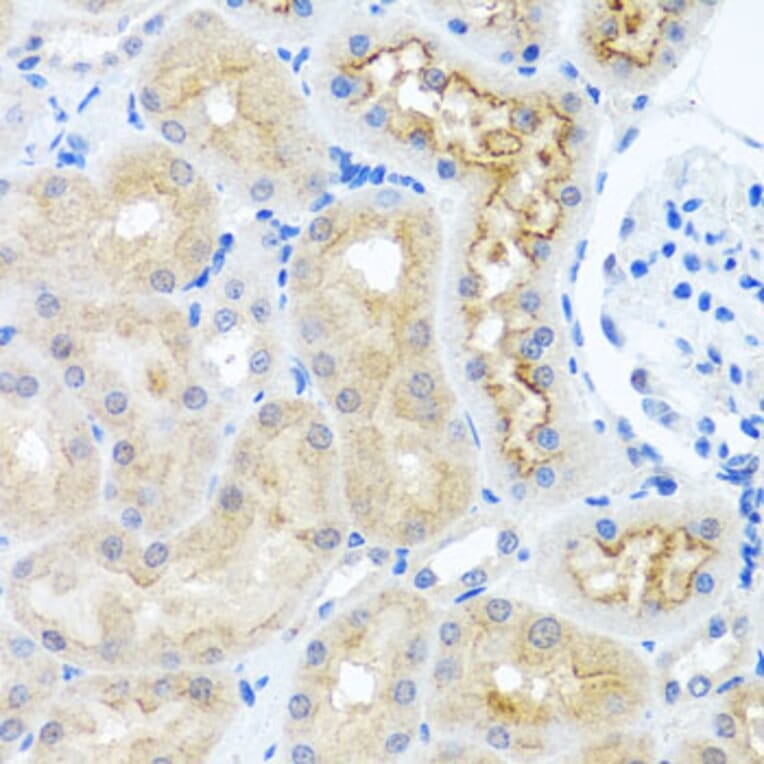 Immunohistochemistry - Anti-RPS2 Antibody (A15352) - Antibodies.com