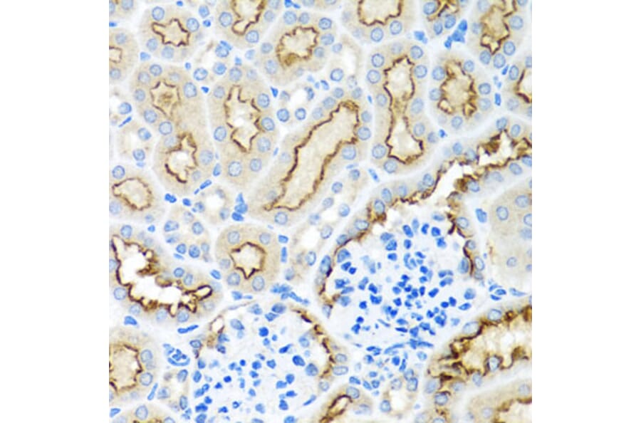 Immunohistochemistry - Anti-RPS2 Antibody (A15352) - Antibodies.com