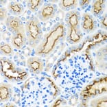 Immunohistochemistry - Anti-RPS2 Antibody (A15352) - Antibodies.com