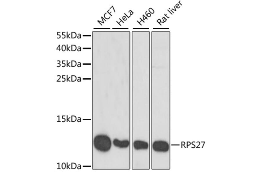 Western Blot - Anti-RPS27/MPS1 Antibody (A15353) - Antibodies.com
