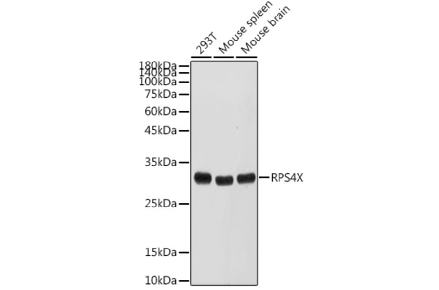 Western Blot - Anti-RPS4X/SCAR Antibody (A15354) - Antibodies.com