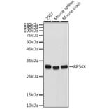 Western Blot - Anti-RPS4X/SCAR Antibody (A15354) - Antibodies.com