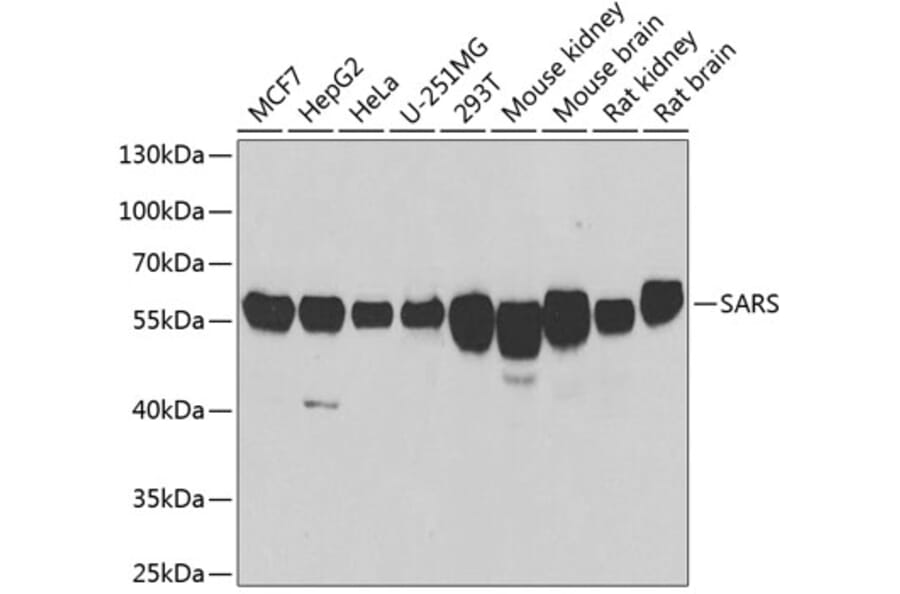 Western Blot - Anti-Seryl-tRNA synthetase/SERS Antibody (A15355) - Antibodies.com
