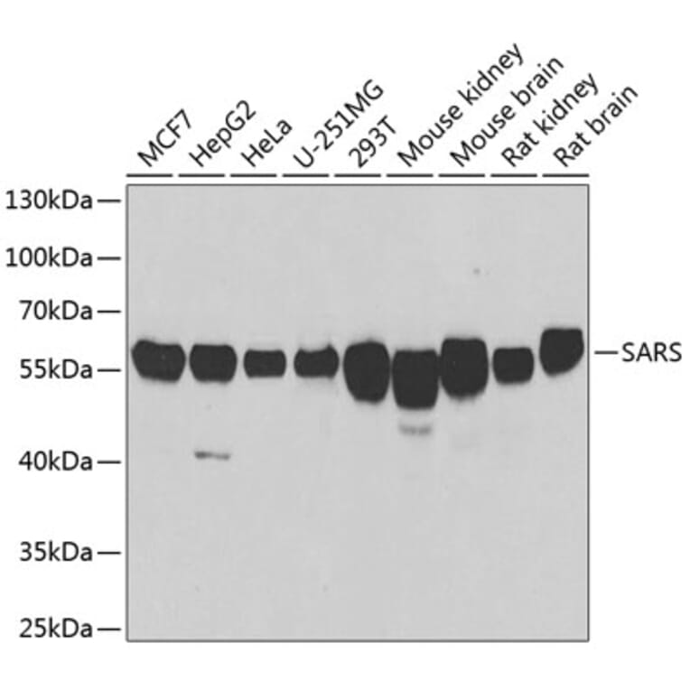 Western Blot - Anti-Seryl-tRNA synthetase/SERS Antibody (A15355) - Antibodies.com
