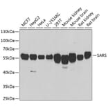 Western Blot - Anti-Seryl-tRNA synthetase/SERS Antibody (A15355) - Antibodies.com