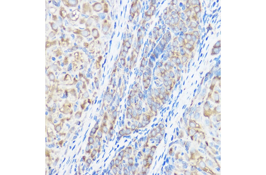 Immunohistochemistry - Anti-Seryl-tRNA synthetase/SERS Antibody (A15355) - Antibodies.com