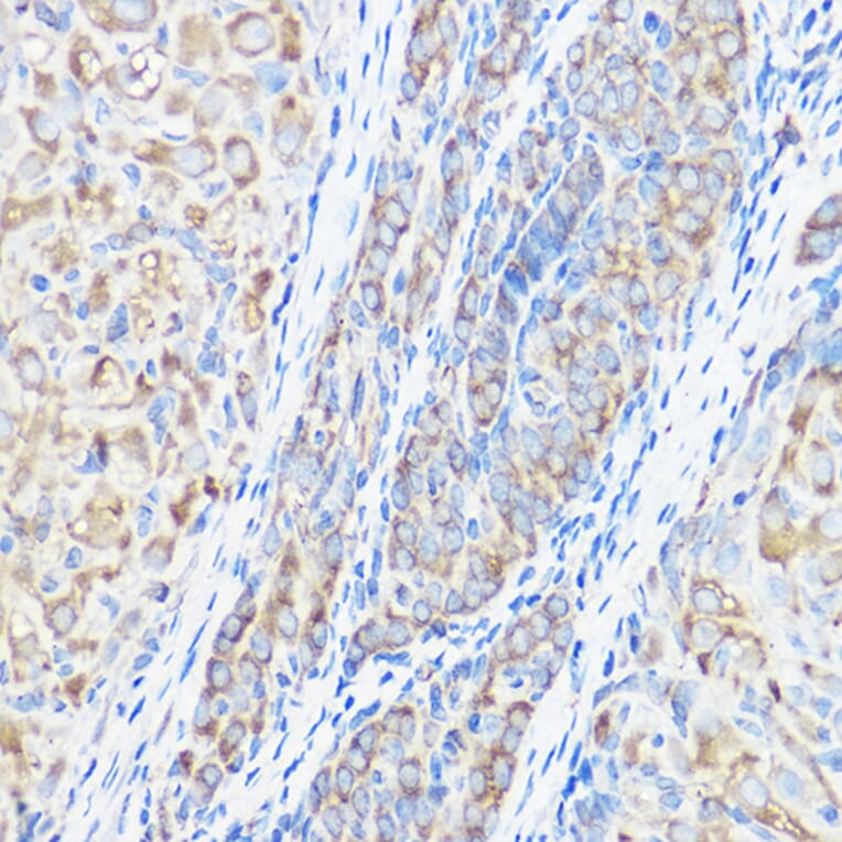 Immunohistochemistry - Anti-Seryl-tRNA synthetase/SERS Antibody (A15355) - Antibodies.com