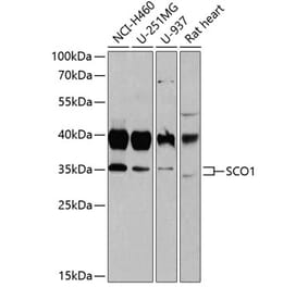 Western Blot - Anti-SCO1 Antibody (A15356) - Antibodies.com