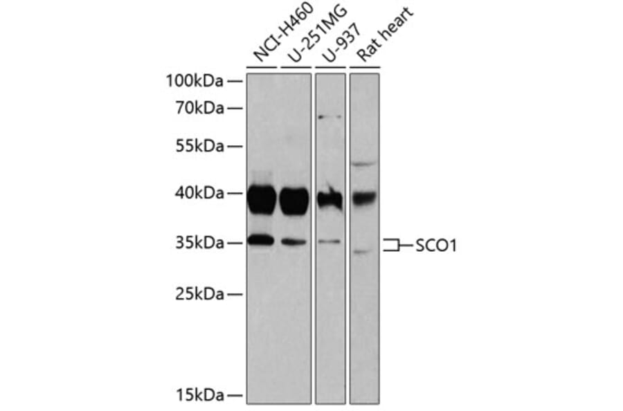 Western Blot - Anti-SCO1 Antibody (A15356) - Antibodies.com