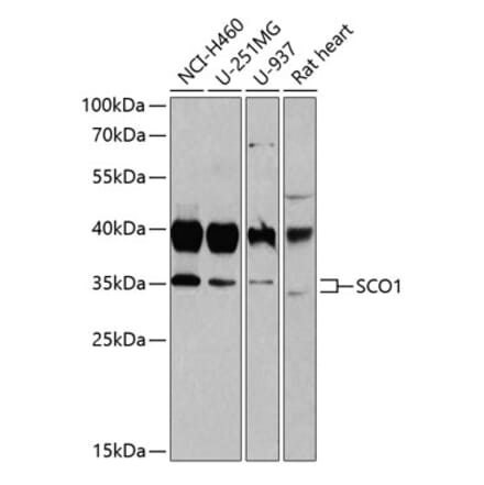 Western Blot - Anti-SCO1 Antibody (A15356) - Antibodies.com