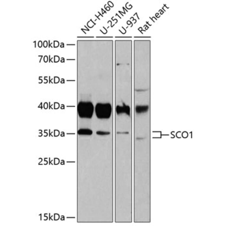 Western Blot - Anti-SCO1 Antibody (A15356) - Antibodies.com