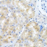 Immunohistochemistry - Anti-SCO1 Antibody (A15356) - Antibodies.com