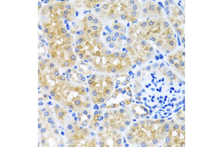 Immunohistochemistry - Anti-SCO1 Antibody (A15356) - Antibodies.com