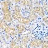 Immunohistochemistry - Anti-SCO1 Antibody (A15356) - Antibodies.com
