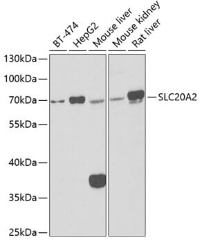 Western blot analysis of extracts of various cell lines, using Anti-SLC20A2 Antibody (A6739) at 1:1,000 dilution.
Secondary antibody: Goat Anti-Rabbit IgG (H+L) (HRP) (AS014) at 1:10,000 dilution.
Lysates / proteins: 25µg per lane.
Blocking buffer: 3% non-fat dry milk in TBST.
Detection: ECL Basic Kit (RM00020).
Exposure time: 90s.