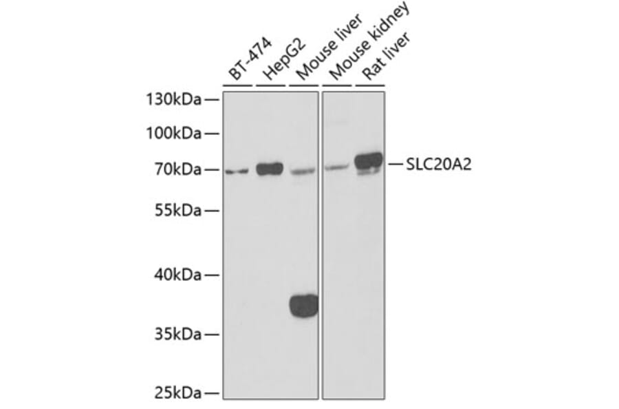 Western Blot - Anti-SLC20A2/PIT2 Antibody (A15357) - Antibodies.com