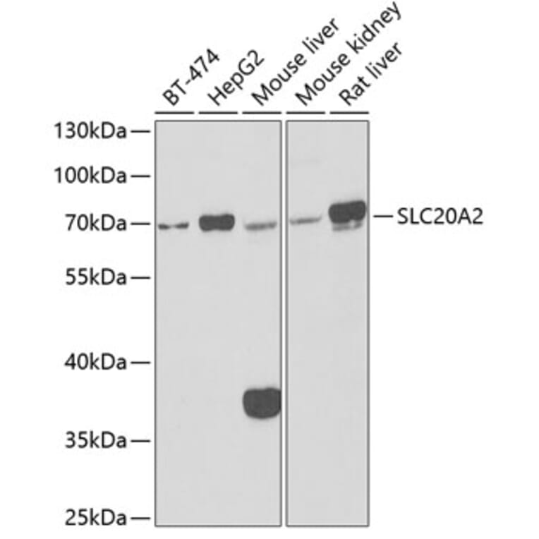 Western Blot - Anti-SLC20A2/PIT2 Antibody (A15357) - Antibodies.com