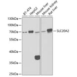 Western Blot - Anti-SLC20A2/PIT2 Antibody (A15357) - Antibodies.com