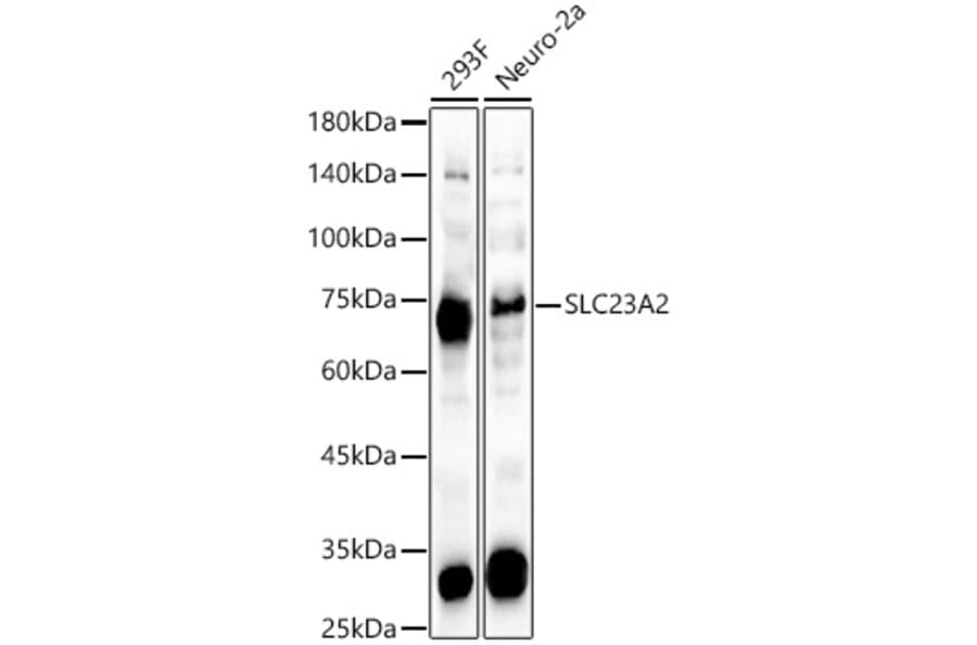 Western Blot - Anti-SLC23A2 Antibody (A15358) - Antibodies.com