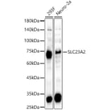 Western Blot - Anti-SLC23A2 Antibody (A15358) - Antibodies.com