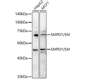 Western Blot - Anti-Acid sphingomyelinase Antibody (A15360) - Antibodies.com