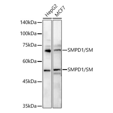 Western Blot - Anti-Acid sphingomyelinase Antibody (A15360) - Antibodies.com