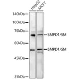 Western Blot - Anti-Acid sphingomyelinase Antibody (A15360) - Antibodies.com