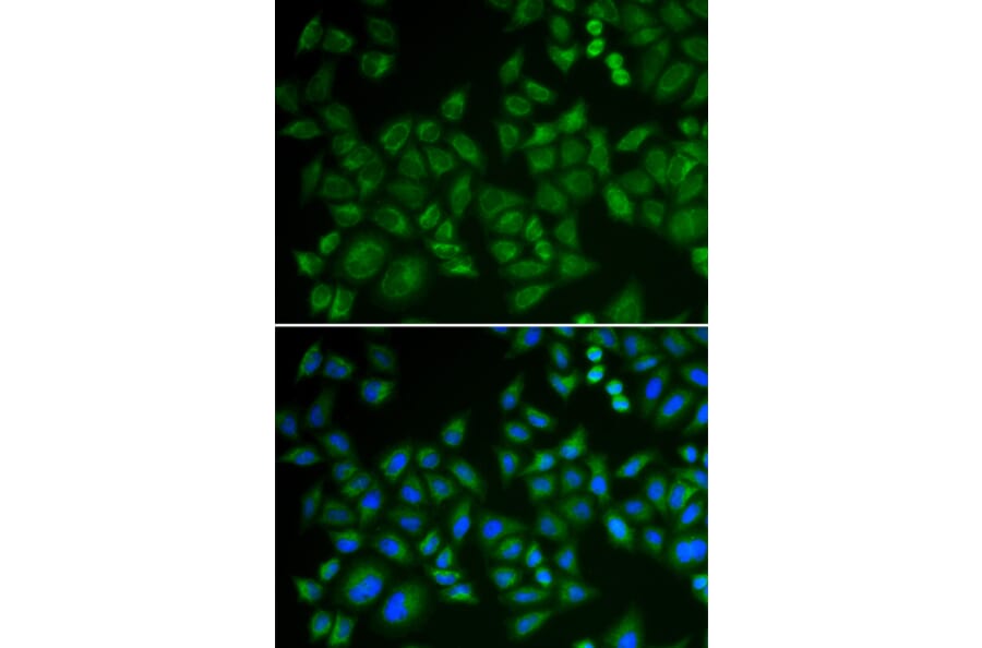 Immunofluorescence - Anti-Acid sphingomyelinase Antibody (A15360) - Antibodies.com