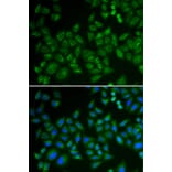 Immunofluorescence - Anti-Acid sphingomyelinase Antibody (A15360) - Antibodies.com